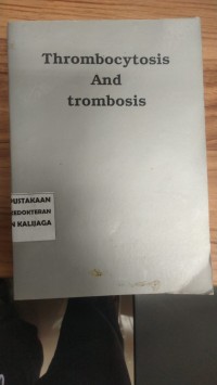 Image of Thrombocytosis and trombosis